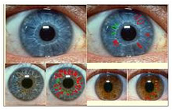 ��Ĥ���w�^���Ԛ�Ѫ�����